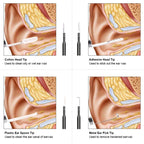 Caméra Otoscope HD pour oreilles