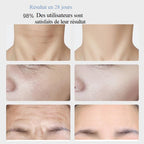 Masseur lifting cou et visage EMS