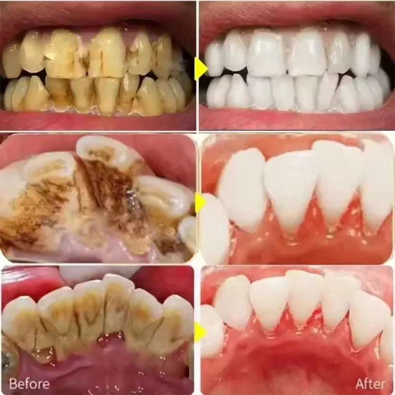 Stylo magique dents blanches