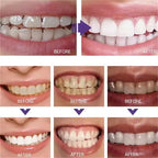 Stylo magique dents blanches