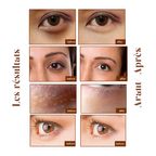 20x Patchs yeux anti-cernes Or Collagène & Acide Hyaluronique